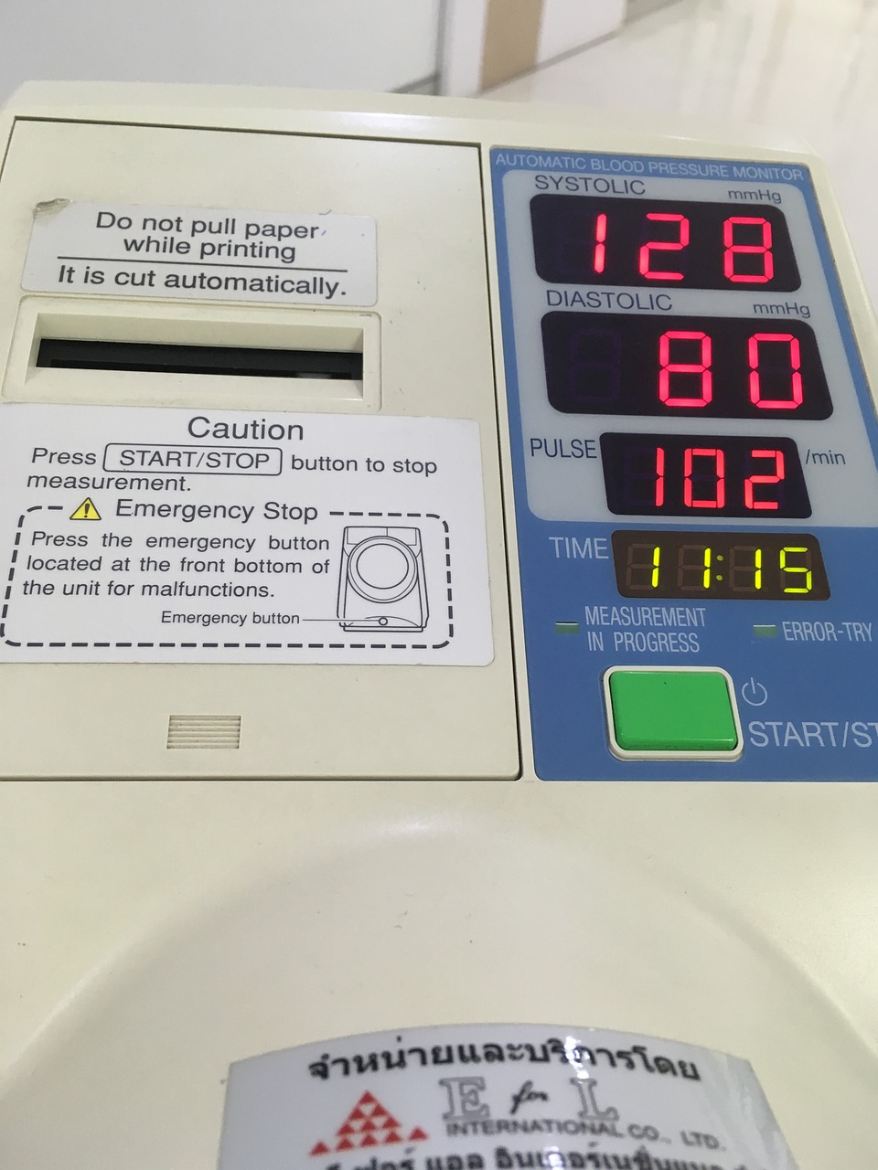 最新心肌梗塞诊疗指南，提升患者生存率与生活品质的关键策略